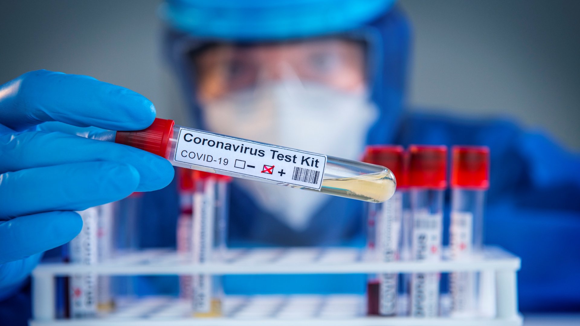Přihlásili byste se jako dobrovolník k testům vakcínu na COVID-19?