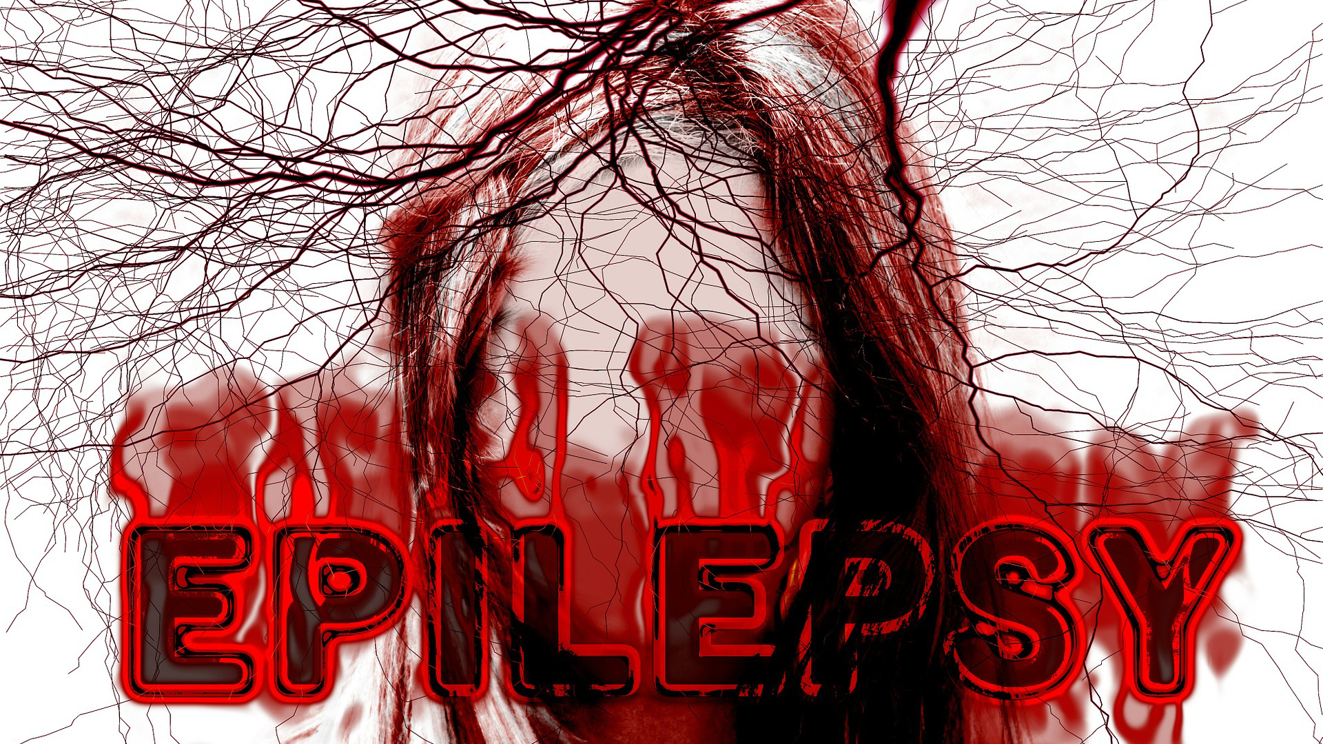 Epilepsie je výpadek mozku