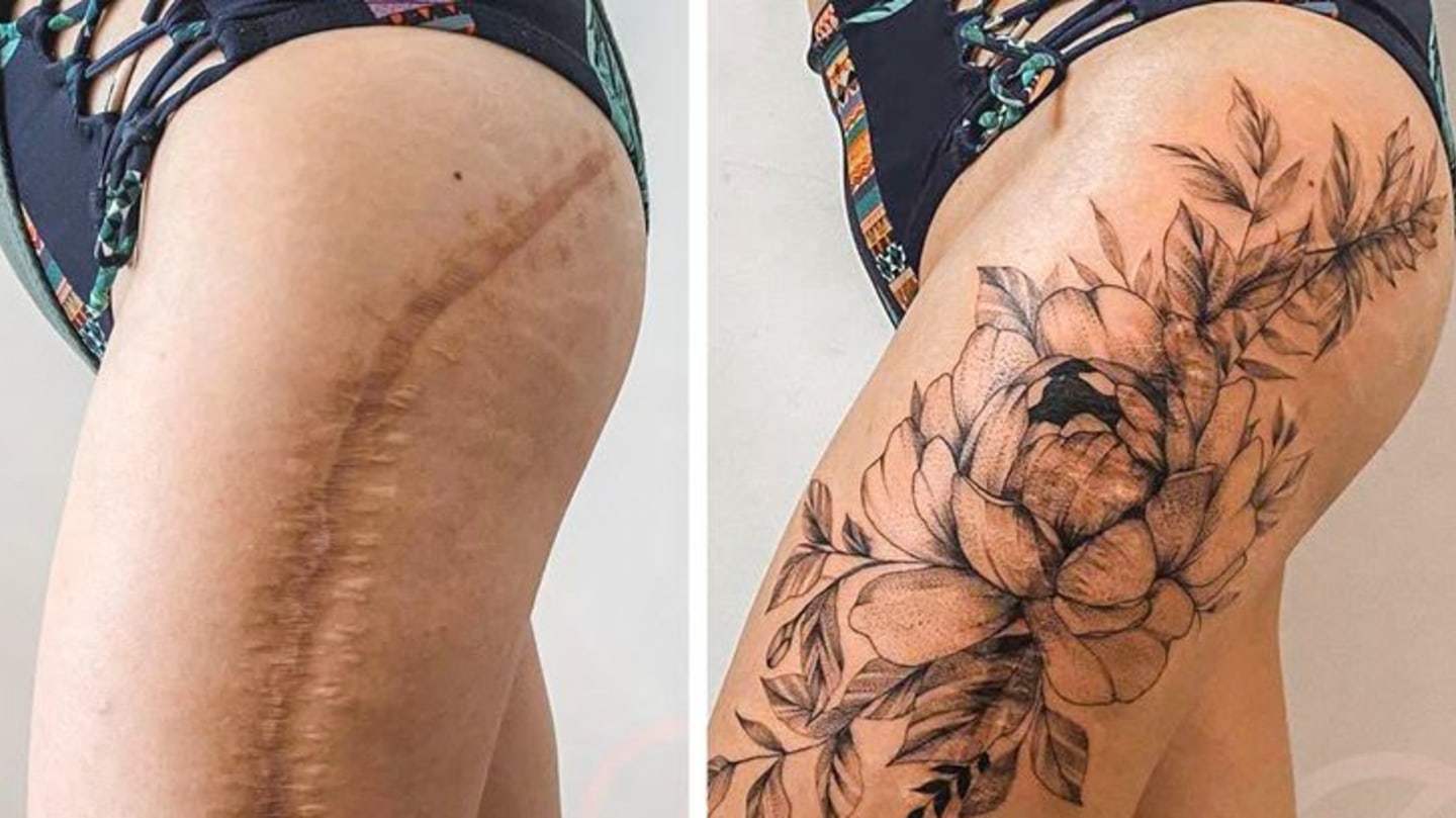 татуировки скрывающие шрамы