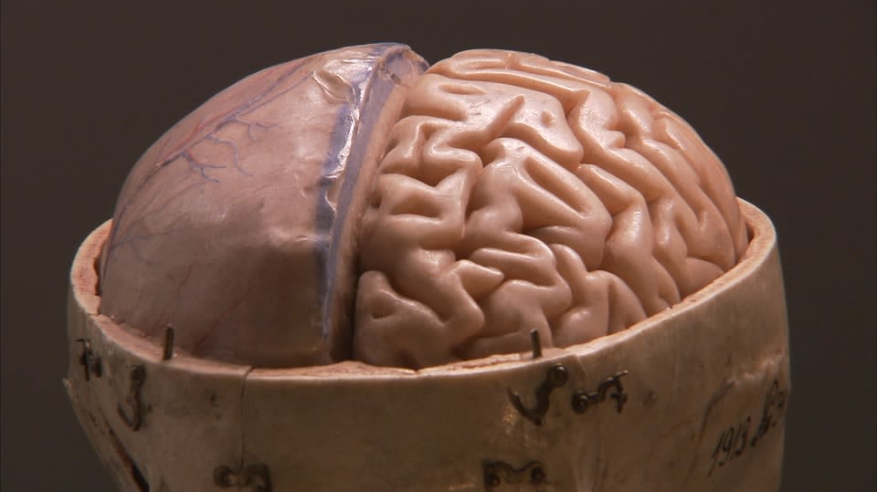 Lidský mozek: Kde sídlí zlo?