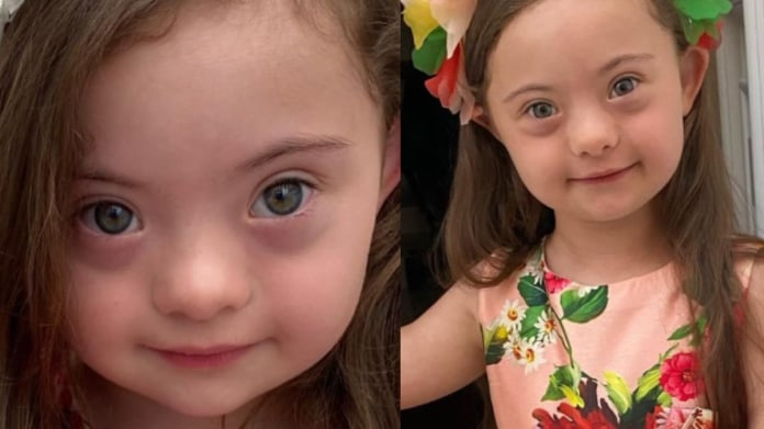 dívka s downovým syndromem dívka s downovým syndromem