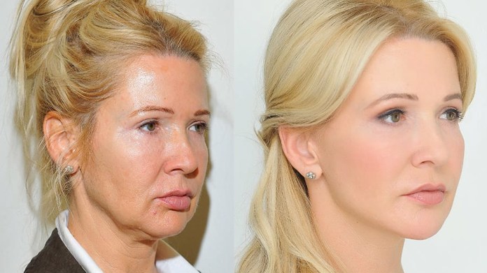 Dermatologie dovede zázraky... Dermatologie dovede zázraky...