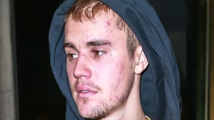 Justin Bieber přiznal zdravotní problémy. Justin Bieber přiznal zdravotní problémy.