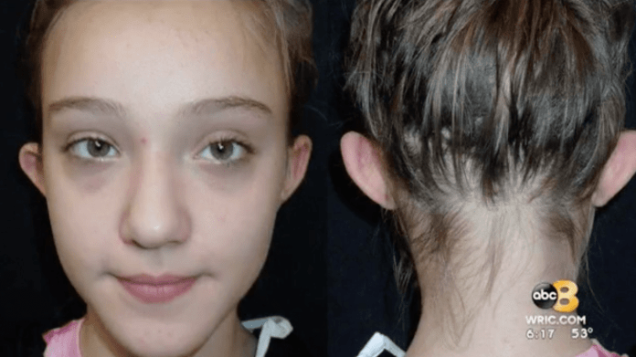 Bella Harrington - Šikana kvůli uším 3 Bella Harrington - Šikana kvůli uším 3