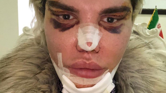 Rodrigo Alves se znovu proměnil 5 Rodrigo Alves se znovu proměnil 5