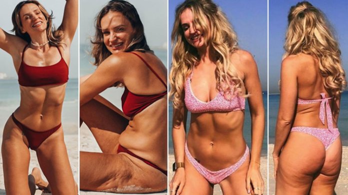 Vaše těla jsou normální, ubezpečuje ženy influencerka vlastními nedokonalostmi Vaše těla jsou normální, ubezpečuje ženy influencerka vlastními nedokonalostmi