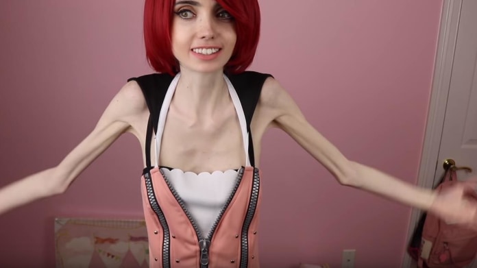 Slavná anorektička 8 Slavná anorektička 8