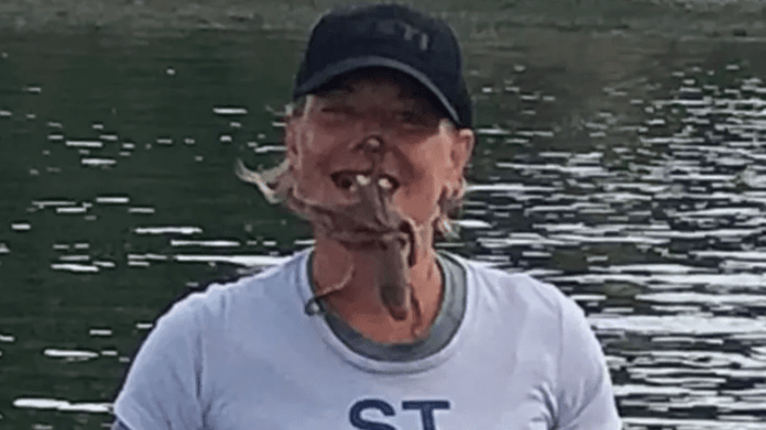 Žena si na obličej položila jedovatou chobotnici 3 Žena si na obličej položila jedovatou chobotnici 3