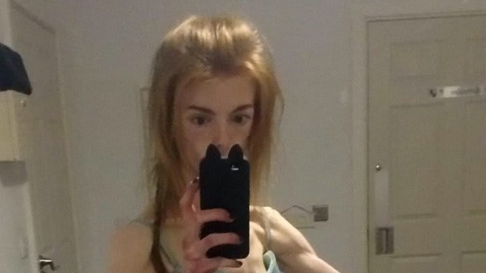 Dívka porazila anorexii čokoládou 1 Dívka porazila anorexii čokoládou 1