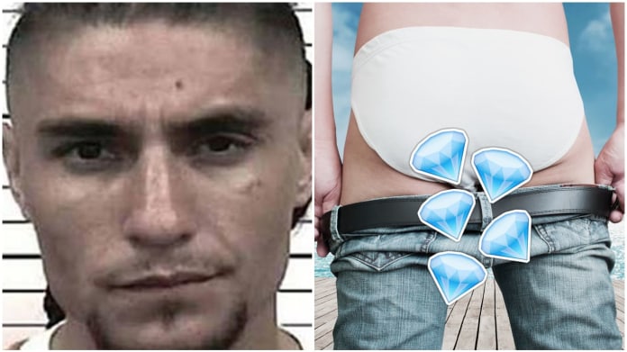 Muži našli diamanty v řitním otvoru 1 Muži našli diamanty v řitním otvoru 1