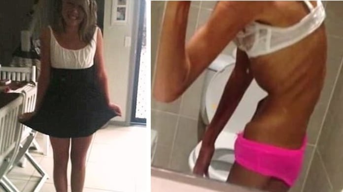 Christie Told svůj boj s anorexií snad vyhrála! Christie Told svůj boj s anorexií snad vyhrála!