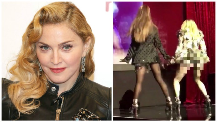 Tají Madonna implantáty? Tají Madonna implantáty?