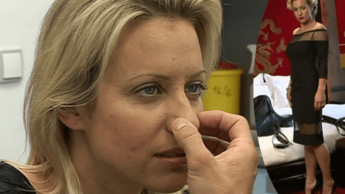 Video VIP zprávy: Tereza Mátlová si nechala udělat plastiku nosu Video VIP zprávy: Tereza Mátlová si nechala udělat plastiku nosu