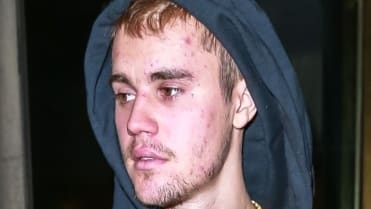 Justin Bieber přiznal zdravotní problémy. Justin Bieber přiznal zdravotní problémy.