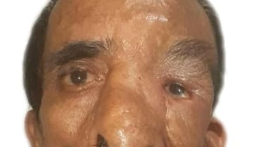 Ashok Shresth (60) Ashok Shresth (60)