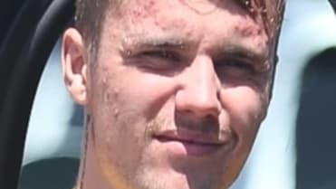 Justin Bieber má navíc také mononukleózu. Justin Bieber má navíc také mononukleózu.
