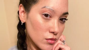 Ženu postihlo vitiligo jen na polovinu obličeje Ženu postihlo vitiligo jen na polovinu obličeje