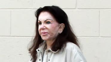 Jackie Stallone (92), i takhle to může dopadnout, když to přeženete s plastikami - Obrázek 3 Jackie Stallone (92), i takhle to může dopadnout, když to přeženete s plastikami - Obrázek 3