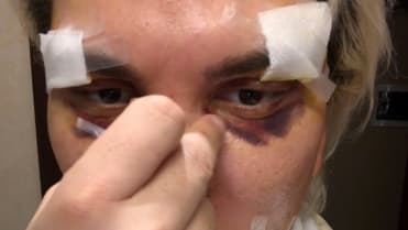 Rodrigo Alves se znovu proměnil 4 Rodrigo Alves se znovu proměnil 4