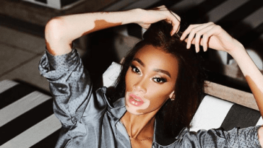 Winnie Harlow (Kanada) Winnie Harlow (Kanada)