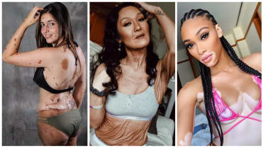Modelky s nevšedním vzhledem Modelky s nevšedním vzhledem