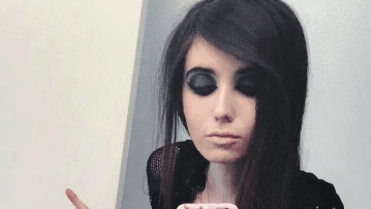 Vážně trpí anorexií. Vážně trpí anorexií.