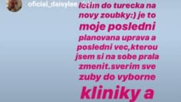 Daisy Lee plánuje nové zuby. Daisy Lee plánuje nové zuby.