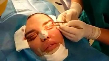 Rodrigo Alves se znovu proměnil 1 Rodrigo Alves se znovu proměnil 1