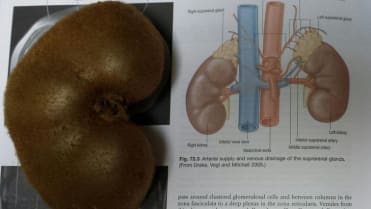 Kiwi, které vypadá jako ledvina. Kiwi, které vypadá jako ledvina.