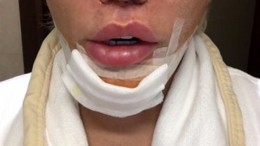Rodrigo Alves se znovu proměnil 2 Rodrigo Alves se znovu proměnil 2