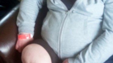 Ženě museli amputovat nohu poté, co se řízla při holení 6 Ženě museli amputovat nohu poté, co se řízla při holení 6