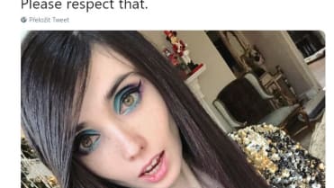 Slavná anorektička 9 Slavná anorektička 9