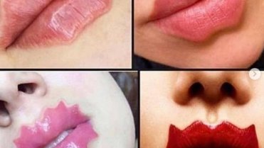 Nový bizarní trend. Vlnité rty 7 Nový bizarní trend. Vlnité rty 7
