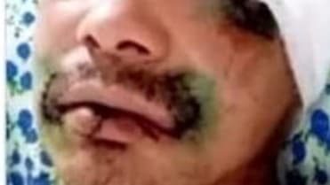 Co dělat, když na vás zaútočí medvěd? Co dělat, když na vás zaútočí medvěd?