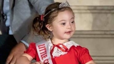 4letá dívka s Downovým syndromem pózuje jako modelka 9 4letá dívka s Downovým syndromem pózuje jako modelka 9