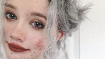 Hailey Wait - Dívka s akné 8 Hailey Wait - Dívka s akné 8