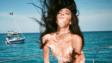Winnie Harlow (Kanada) Winnie Harlow (Kanada)