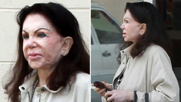 Jackie Stallone (92), i takhle to může dopadnout, když to přeženete s plastikami Jackie Stallone (92), i takhle to může dopadnout, když to přeženete s plastikami
