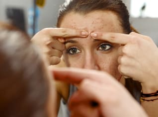 Akné, bradavice, lupy: Banální problémy, které mohou přerůst v noční můru Akné, bradavice, lupy: Banální problémy, které mohou přerůst v noční můru