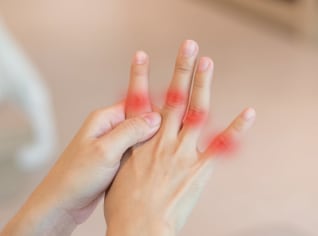 Bolí vás a otékají vám klouby? Možná vás trápí dna Bolí vás a otékají vám klouby? Možná vás trápí dna