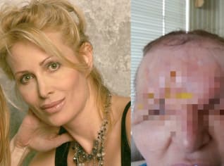 Carol Bryan před a po Carol Bryan před a po