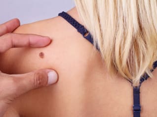 Rakovinu kůže vám může způsobit i slunce, které svítí přes okna do kanceláře Rakovinu kůže vám může způsobit i slunce, které svítí přes okna do kanceláře
