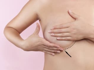 Plastika prsou - změnily se hlavně implantáty Plastika prsou - změnily se hlavně implantáty