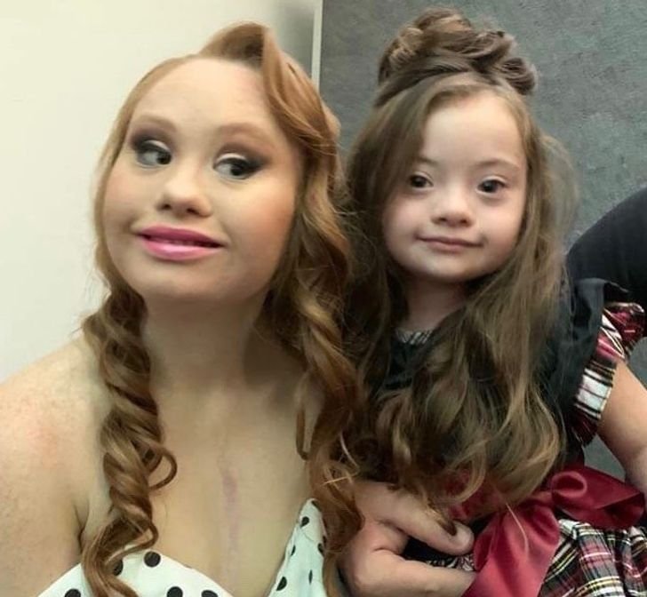 4letá dívka s Downovým syndromem pózuje jako modelka 5 4letá dívka s Downovým syndromem pózuje jako modelka 5
