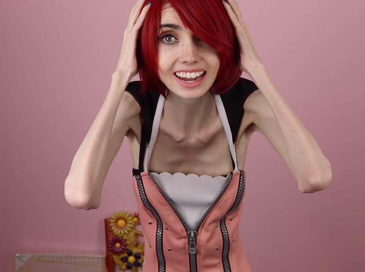 Slavná anorektička 6 Slavná anorektička 6