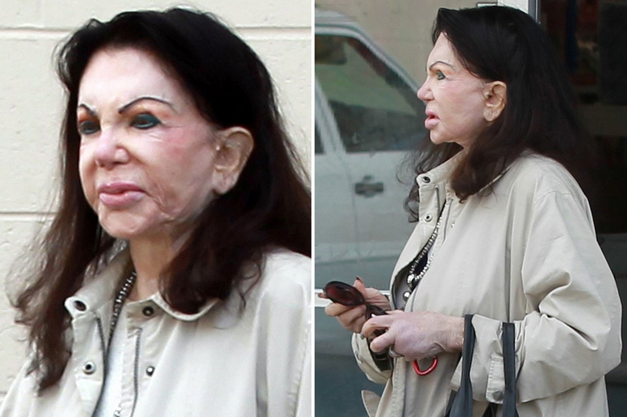 Jackie Stallone (92), i takhle to může dopadnout, když to přeženete s plastikami Jackie Stallone (92), i takhle to může dopadnout, když to přeženete s plastikami