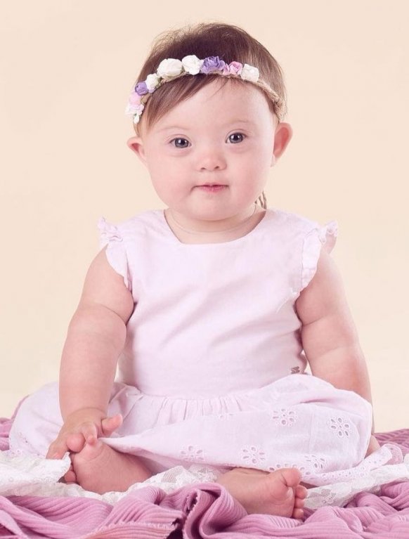 4letá dívka s Downovým syndromem pózuje jako modelka 1 4letá dívka s Downovým syndromem pózuje jako modelka 1