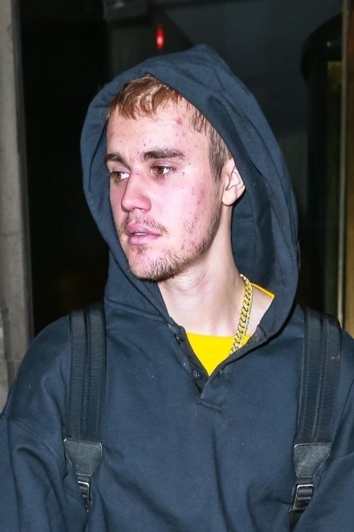 Justin Bieber přiznal zdravotní problémy. Justin Bieber přiznal zdravotní problémy.