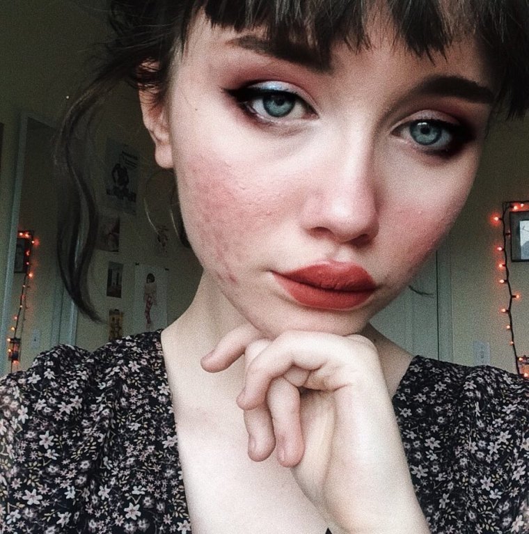 Hailey Wait - Dívka s akné 10 Hailey Wait - Dívka s akné 10