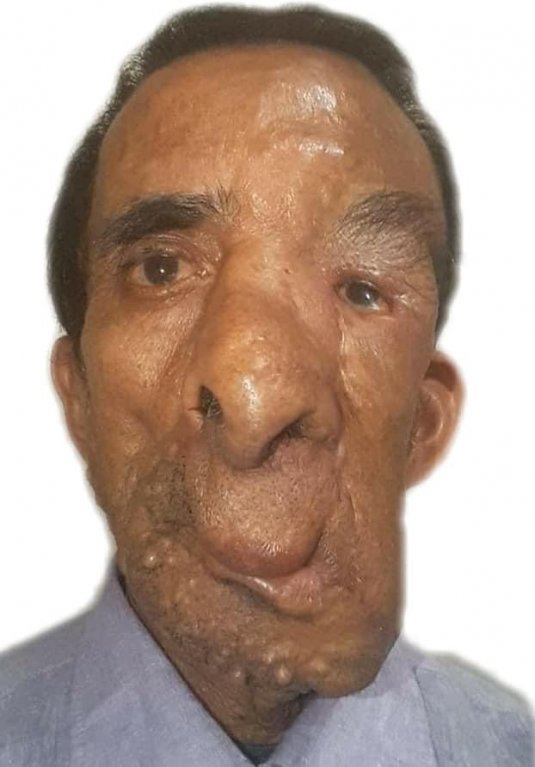 Ashok Shresth (60) Ashok Shresth (60)